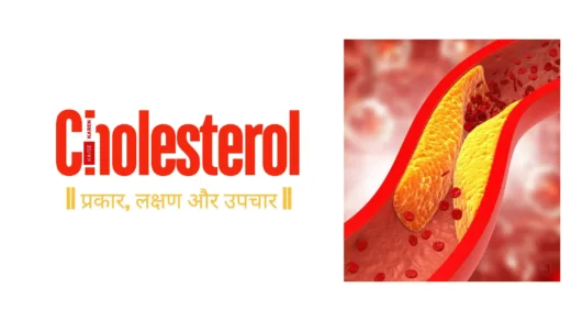 Cholesterol Symptoms, Cholesterol Kya Hota Hai, Cholesterol Control Diet, Cholesterol Hdl Means, Cholesterol Badhane Ke Lakshan, Cholesterol Symptoms In Hindi, Cholesterol In Hindi,
